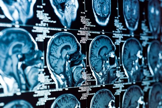 Adult dyslexia and reading: A series of CAT scans of the human brain.