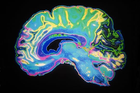 MRI scan of the human brain. fMRI scans of the brain show that after specialized reading instruction, the brain changes. Adult dyslexia and reading.