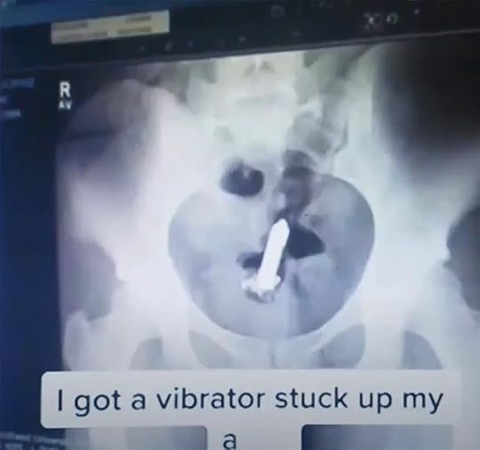 lost vibrator