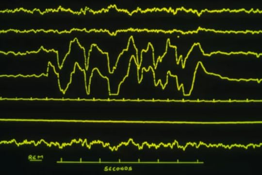 Tidur REM. Penomoran jejak dari atas ke bawah, 1 & 2 adalah elektroensefalogram (EEG) aktivitas otak; 3 adalah elektrookulogram (EOG) gerakan mata kanan; 4 EOG mata kiri; 5 adalah elektrokardiogram ( EKG) jejak aktivitas jantung.6 & 7 adalah elektromiogram (EMG) aktivitas di otot laring (6) dan leher (7).