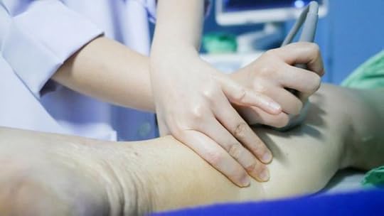 Varicose Vein Treatment