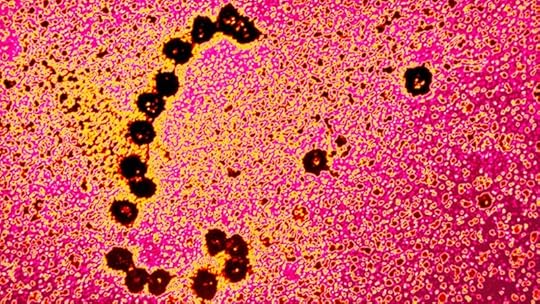 Coloured TEM of ribosomes translating MRNA strand.