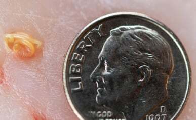 Podcast art showing a dime and a seal worm in fish flesh.