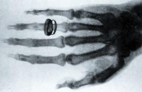 x_ray hand