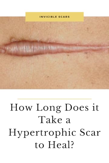 Pin on Scar Healing Tips