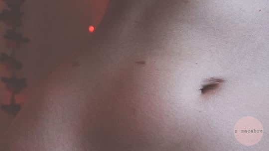 Z Macabre's stomach showing their hysterectomy scars