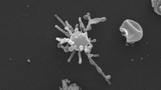 a micrograph of an ancient microbe with a spherical main cell body and bumpy tentacles that extend outwards in all directions