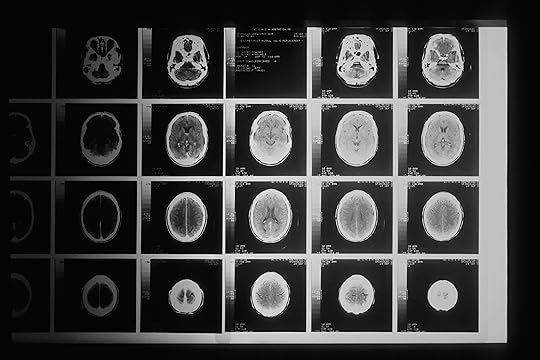 Biomedical Image Segmentation