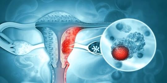 Uterine cancer