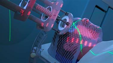 radiation treatment