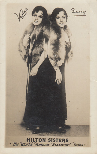 Daisy and Violet Hilton