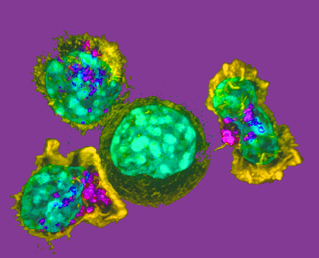 Killer_T_cells3_surround_a_cancer_cell