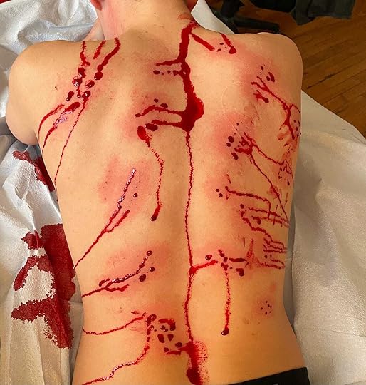 David's back with needle holes and blood