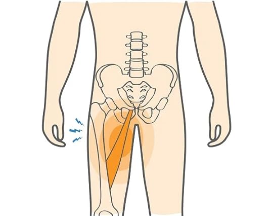 Groin pain running