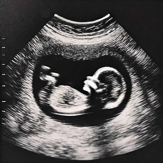 A picture of an 8 week old fetus.