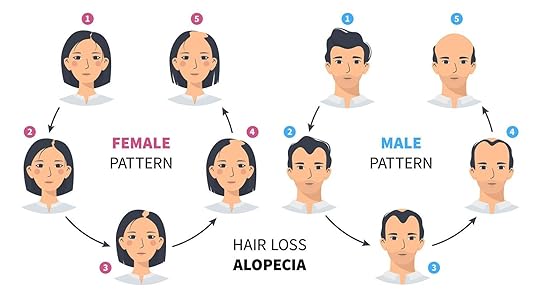 alopecia