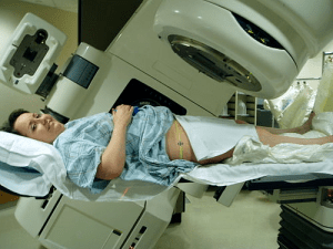 Radiation therapy - Reflections on Prostate Cancer
