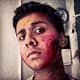 Shitesh