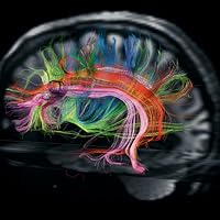 【裁断済】Analyzing Neural Time Series Data ModelDB: Show Model
