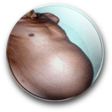 Male Pregnancy